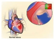 De que forma válvulas cardíacas anormais podem provocar insuficiência cardíaca